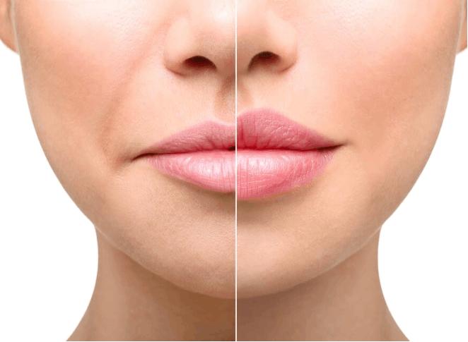 Beauty consultation at Beauty For Less Clinics Dubai