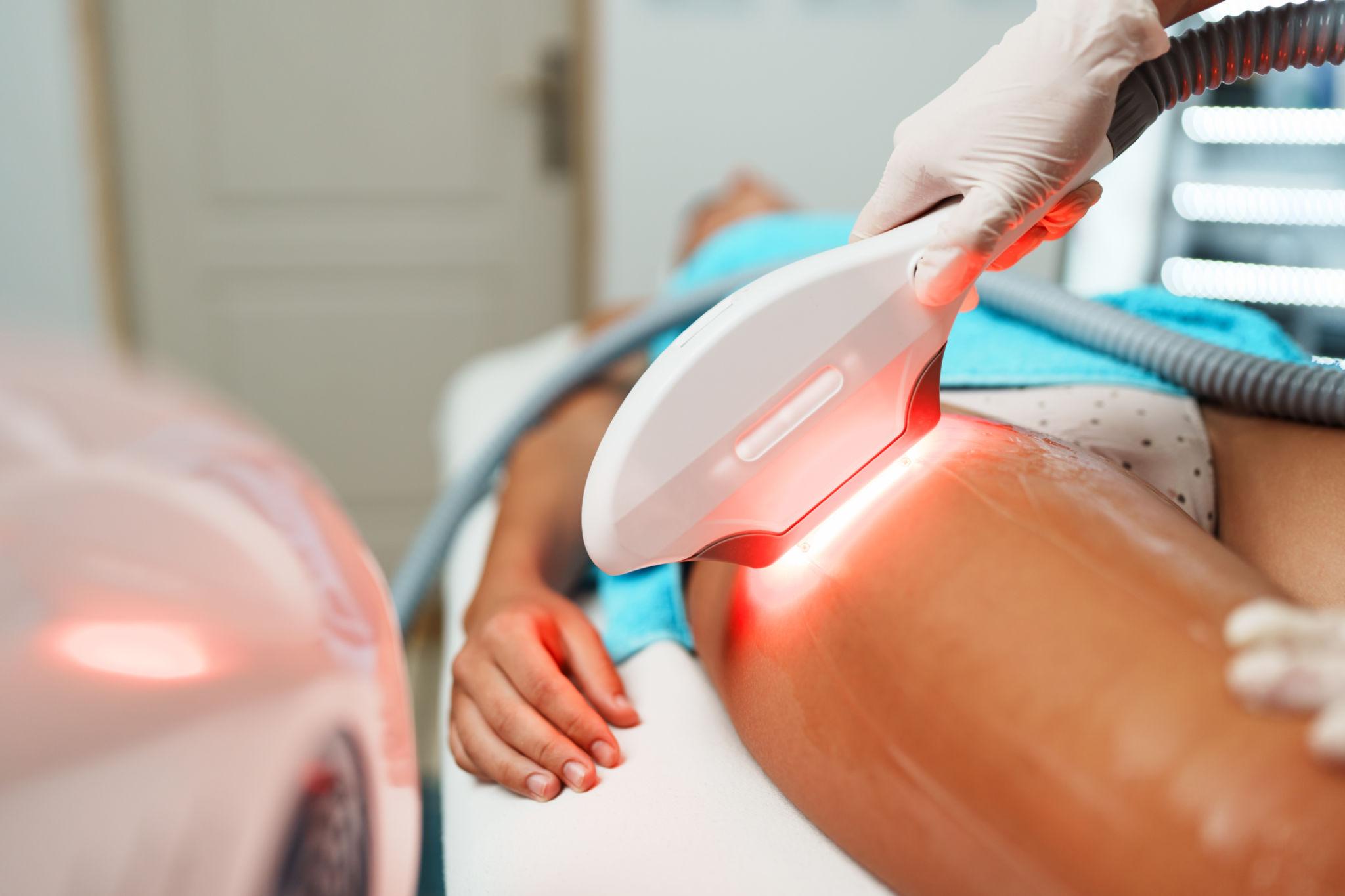 Laser hair removal Dubai Cynosure Elite Plus